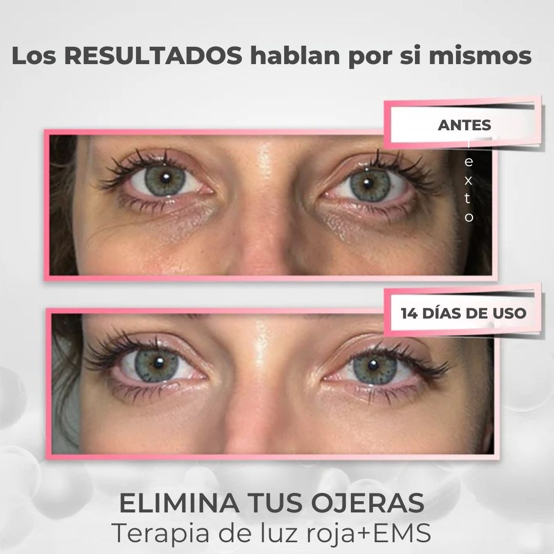 VitalEyes™ Terapia ocular con luz roja 2 en 1